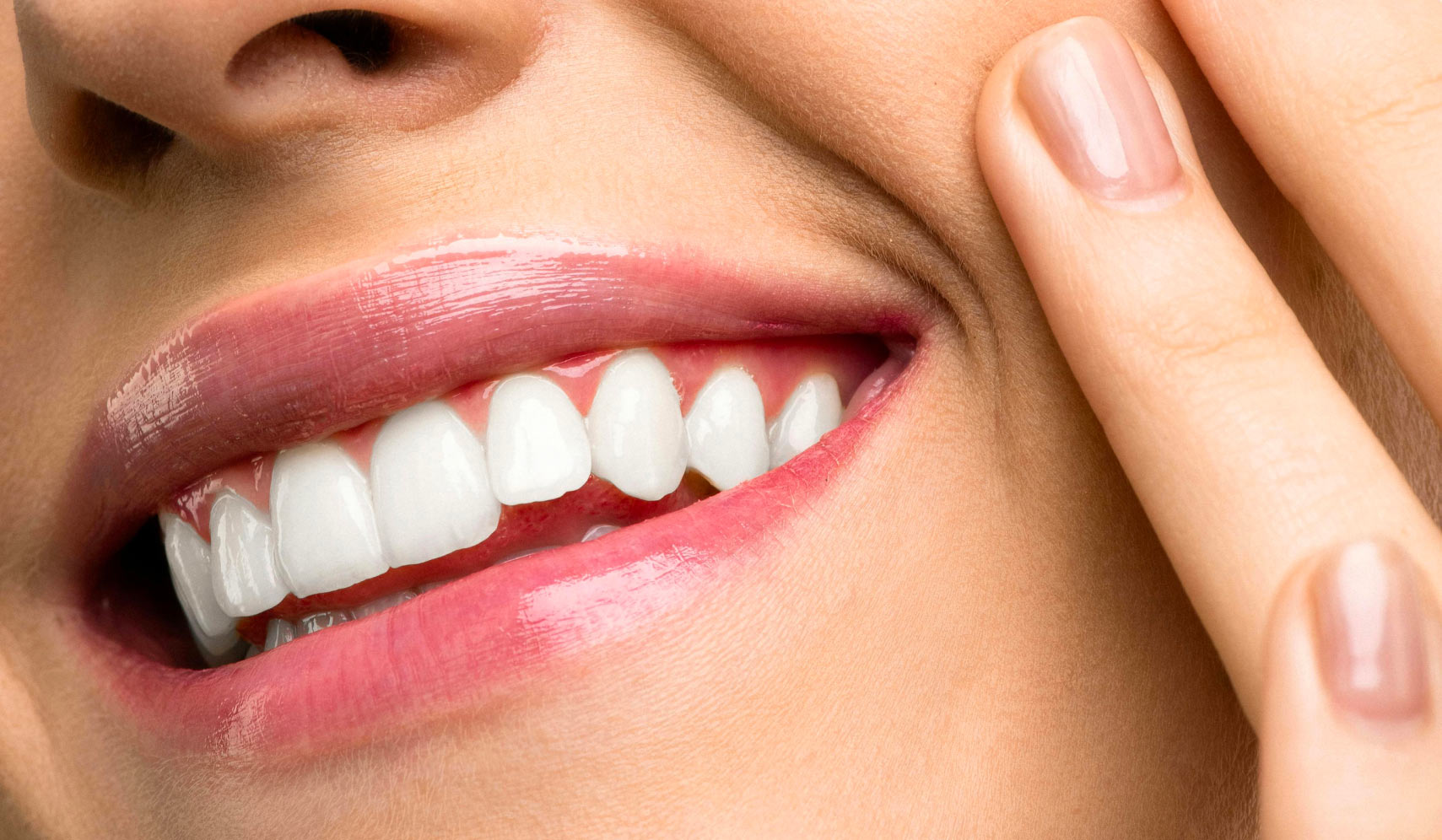 dents blanches