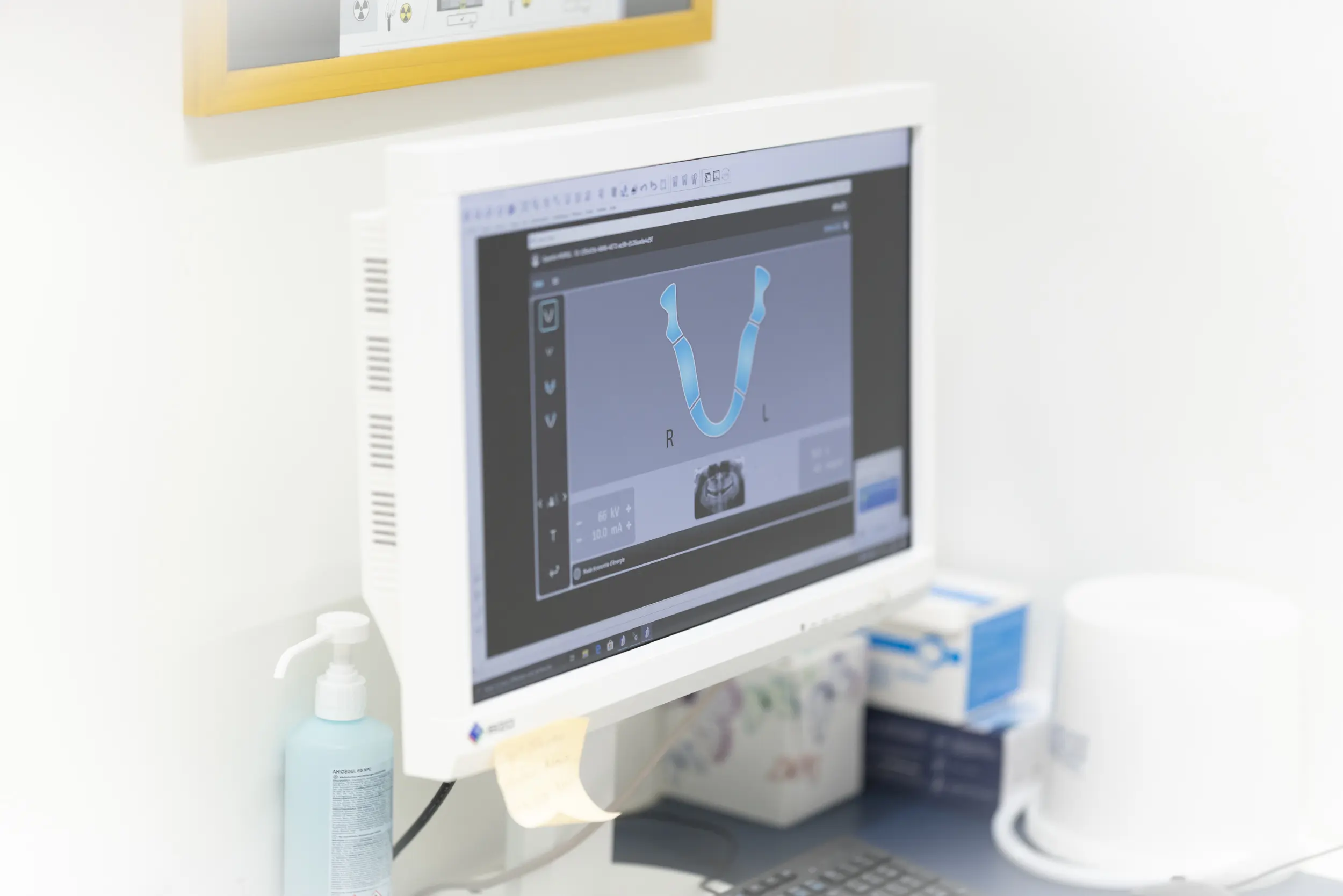 radiographie 3D numérique